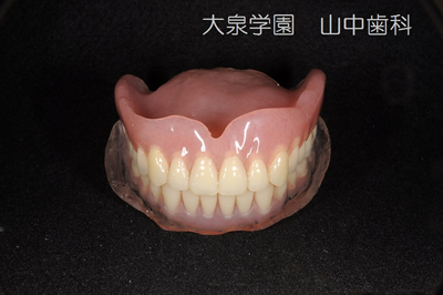 完成義歯