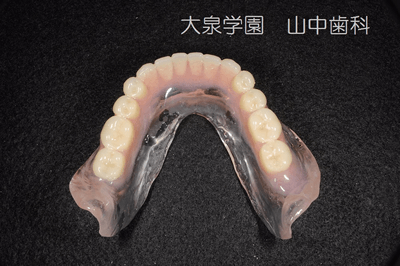 下顎　治療用義歯